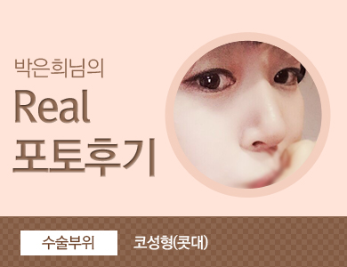 광주성형외과 리얼스토리