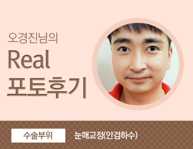 광주성형외과 리얼스토리