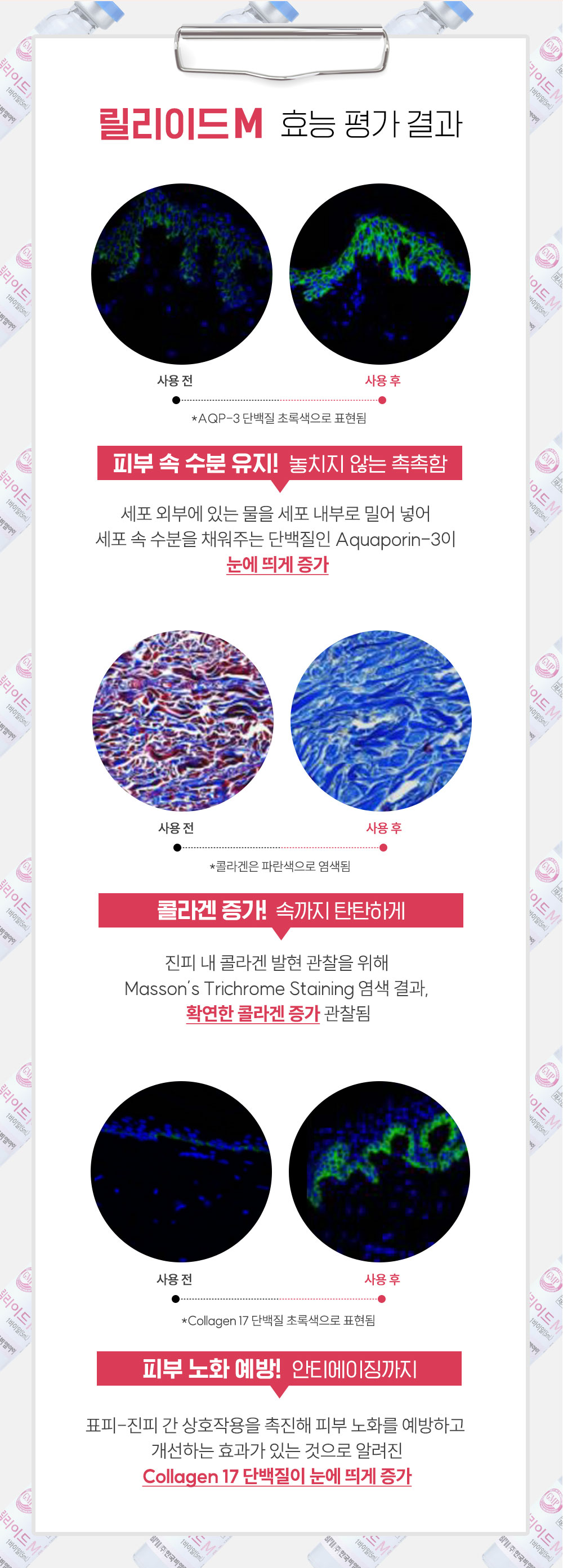 광주성형외과 릴리이드M 묽은 점성 높은 흡수력 즉각적인 피부 개선 효과