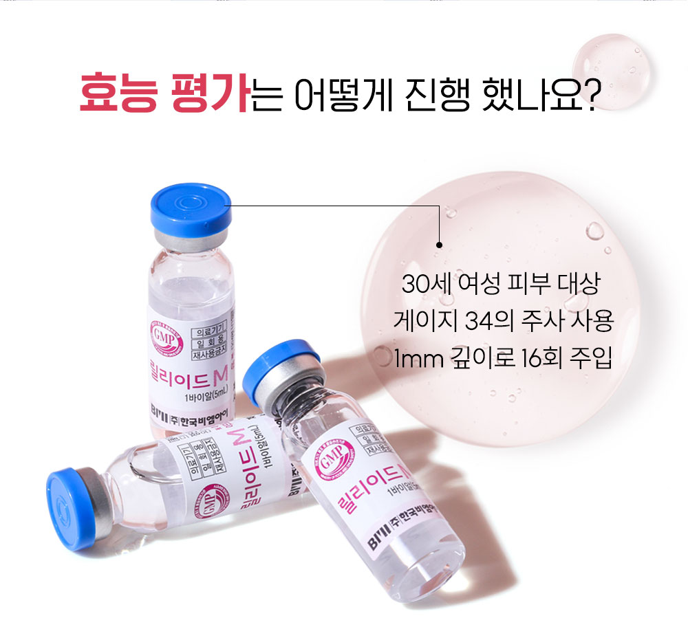 광주성형외과 릴리이드M 효능 평가 30세 여성 피부 대상 게이지 34 주사 1mm 깊이 16회 주입